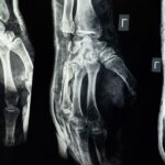 Dauer einer Banküberweisung zur Röntgenuntersuchung