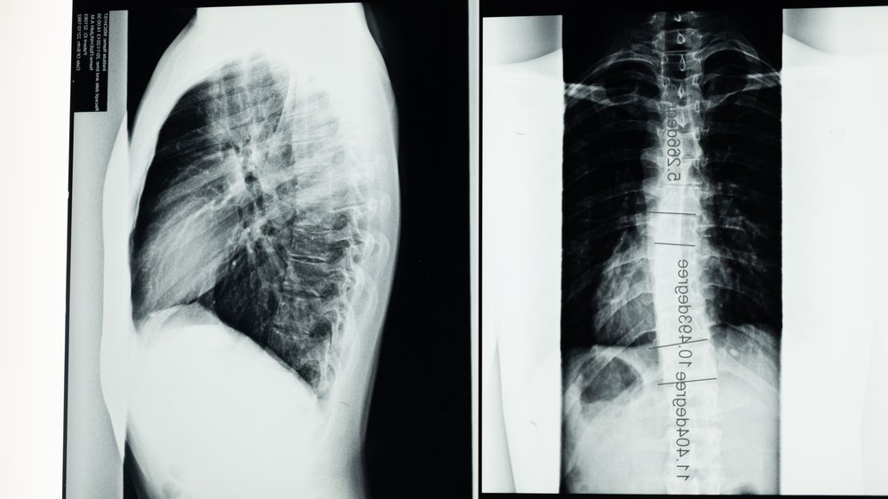 röntgen ohne überweisung